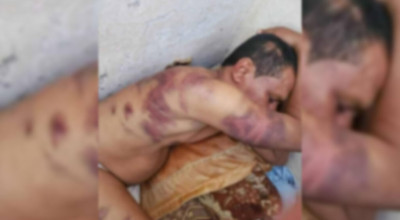 هل الصورة لمواطن تعرض للتعذيب في سجون مأرب؟