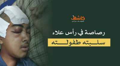 رصاصة في رأس علاء سلبته طفولته