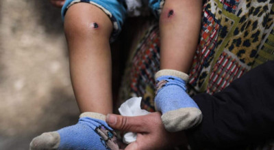 حسابات تكذّب تعذيب جنود الاحتلال للطفل جواد أبو نصار بغزة