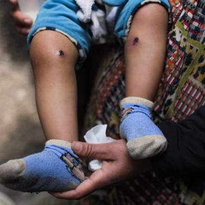 حسابات تكذّب تعذيب جنود الاحتلال للطفل جواد أبو نصار بغزة