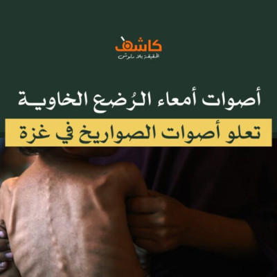 أصوات أمعاء الرُضع الخاوية تعلو أصوات الصواريخ في غزة