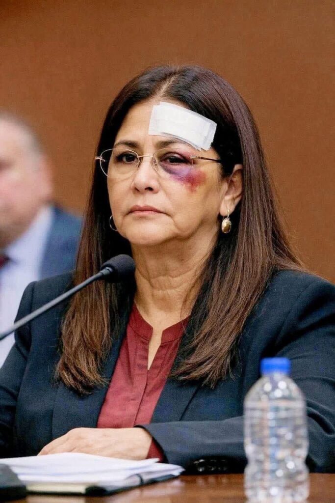 صورة زوجة الرئيس الفنزويلي سيليا فلوريس مولَّدة بالذكاء الاصطناعي