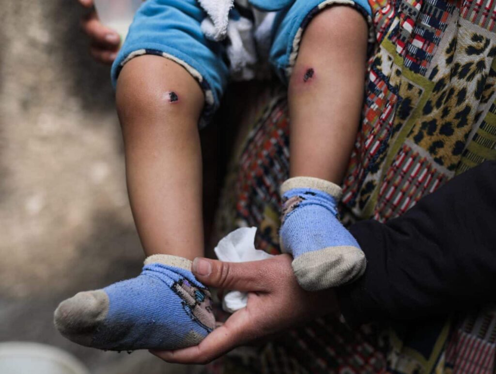 حسابات تكذّب تعذيب جنود الاحتلال للطفل جواد أبو نصار بغزة