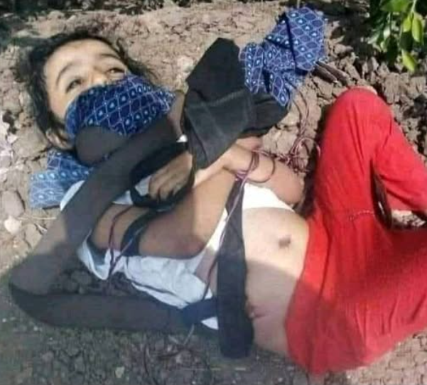 حقيقة الصورة المتداولة لجثة طفلة عُثر عليها في تعز